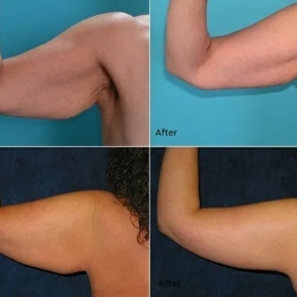 Flabuless - Picture 2 of 3